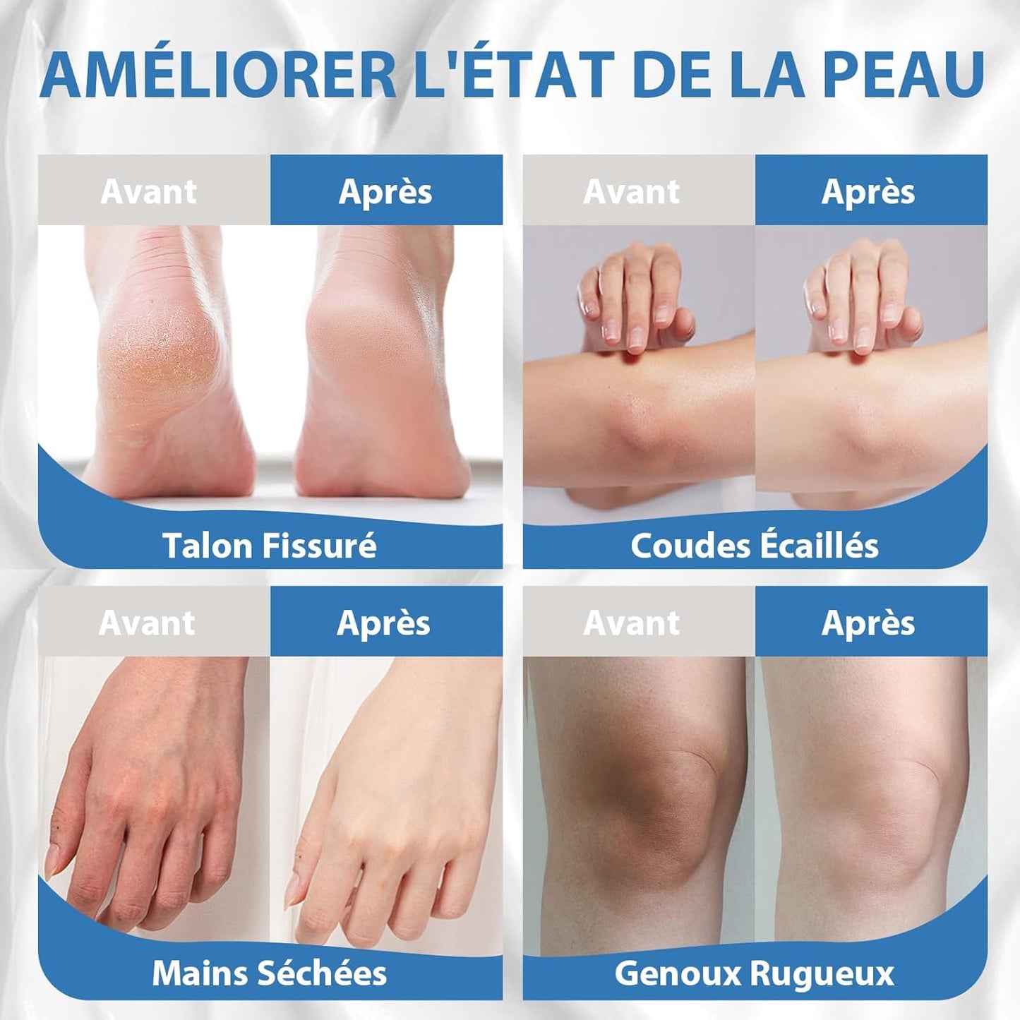 UREA Cream Pieds 250ml
